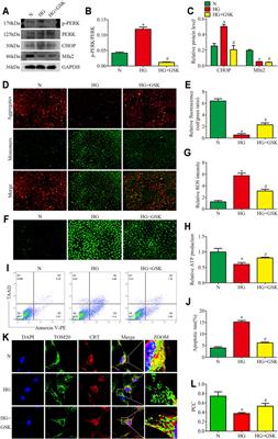 Mfn2 Regulates High Glucose-Induced MAMs Dysfunction and Apoptosis in Podocytes via PERK Pathway